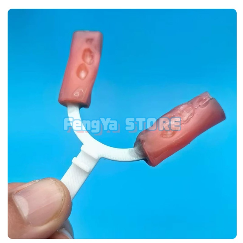 10 Peças/Saco Garfo de Mordida - 3D Printing Orthodontics avaliação e preço