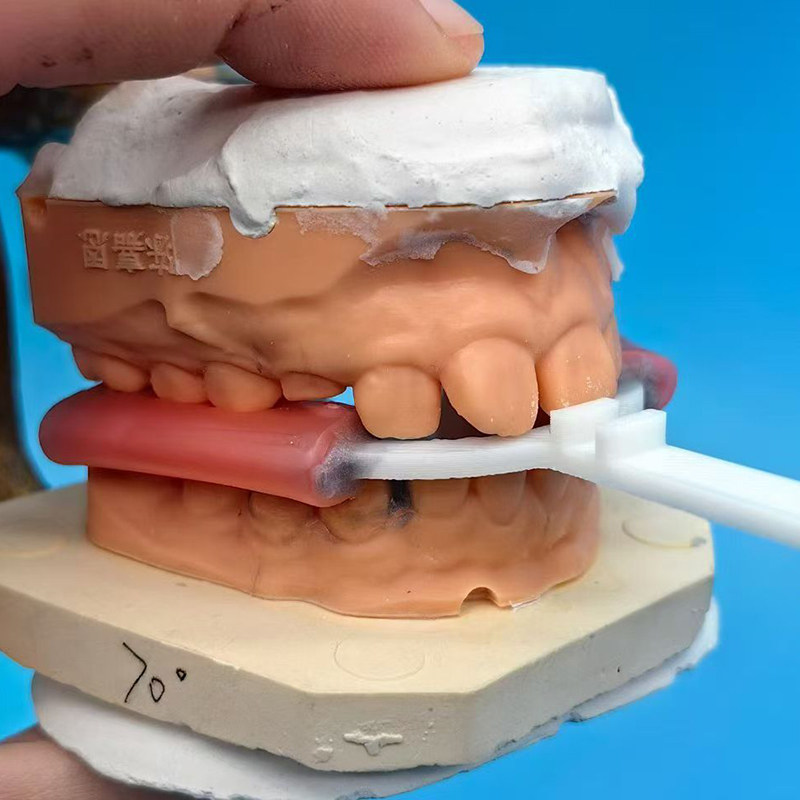 10 Peças/Saco Garfo de Mordida - 3D Printing Orthodontics avaliação e preço