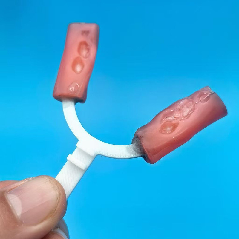 10 Peças/Saco Garfo de Mordida - 3D Printing Orthodontics avaliação e preço